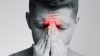 Natural Way to Manage Sinusitis